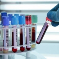 lab dönüştürücü